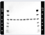 Visualizando la quimioluminiscencia con el UVP Biospectrum Advanced
